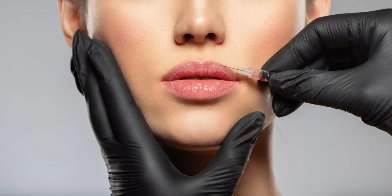 What to Expect From a Lip Fillers Treatment